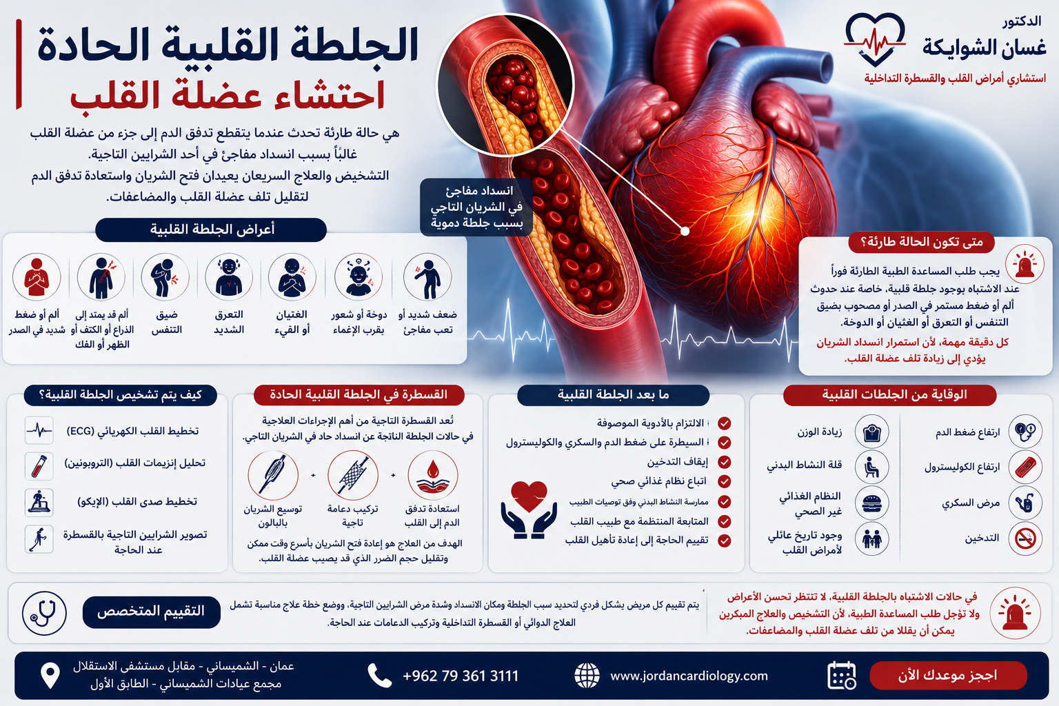 الجلطة القلبية الحادة | احتشاء عضلة القلب في الاردن 