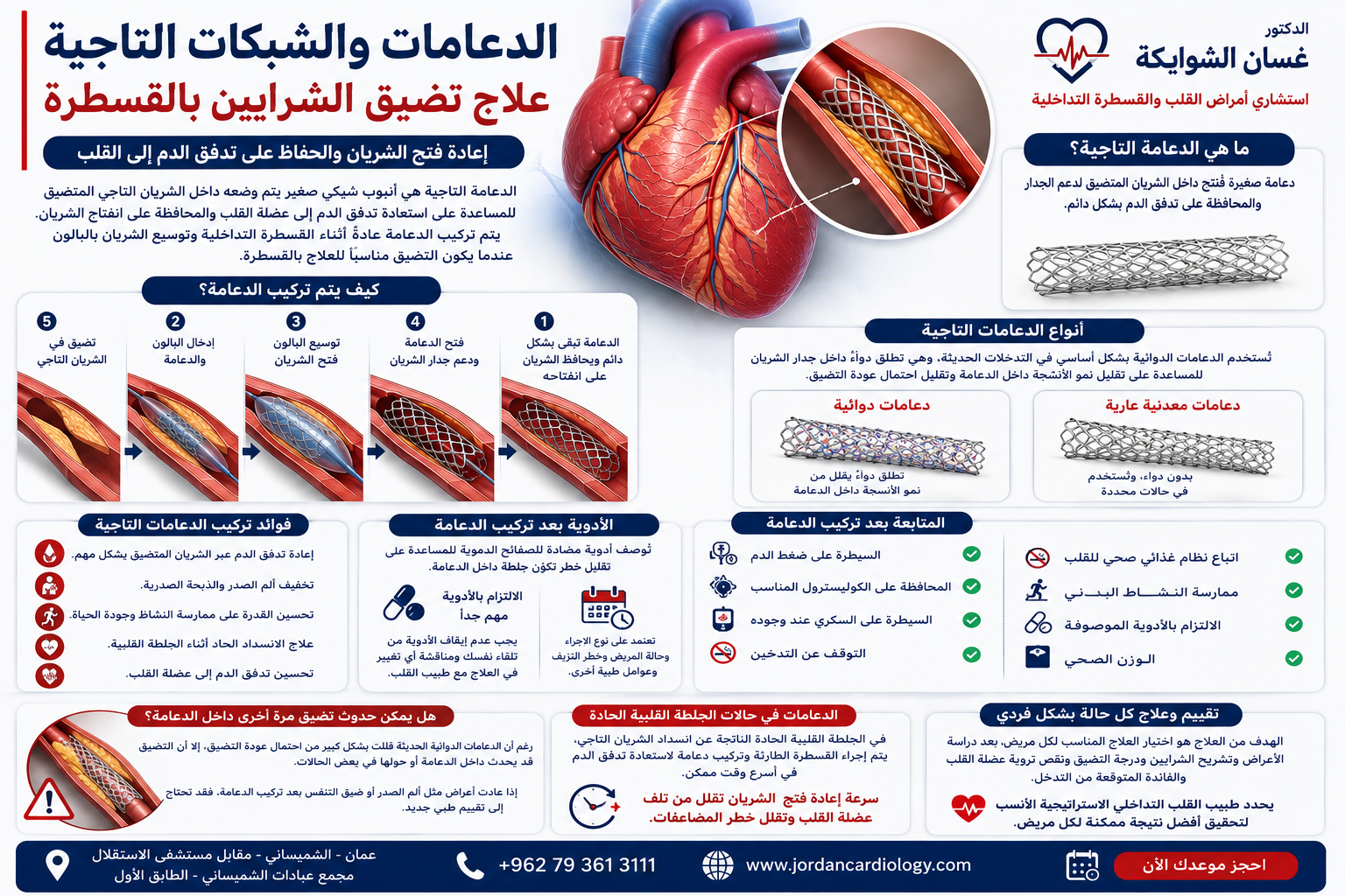 الدعامات والشبكات التاجية | علاج تضيق الشرايين بالقسطرة في الاردن 