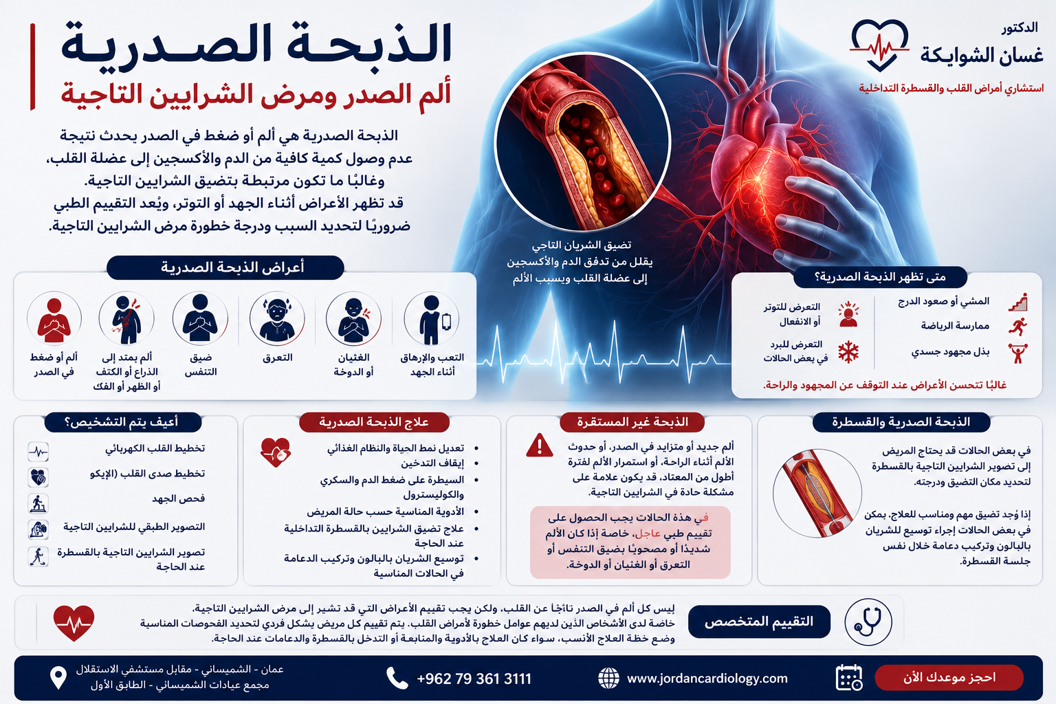 الذبحة الصدرية | ألم الصدر ومرض الشرايين التاجية في الاردن 