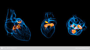 Heart Valves In Jordan 