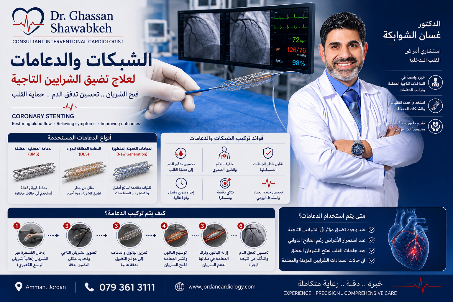 الدكتور غسان الشوابكة استشاري أمراض القلب والقسطرة التداخلية في الأردن، ولديه خبرة واسعة في توسيع الشرايين التاجية وتركيب الشبكات والدعامات. تُعد قسطرة توسيع الشرايين وتركيب الدعامة من الإجراءات التداخلية طفيفة التوغل التي تهدف إلى فتح الشرايين التاجية المتضيقة أو المسدودة، وتحسين تدفق الدم إلى عضلة القلب، وتخفيف الأعراض مثل ألم الصدر وضيق التنفس. يتم تقييم كل مريض بشكل دقيق لتحديد مدى الحاجة إلى التوسيع وتركيب الدعامة واختيار العلاج الأنسب حسب شدة وموقع تضيق الشرايين التاجية.